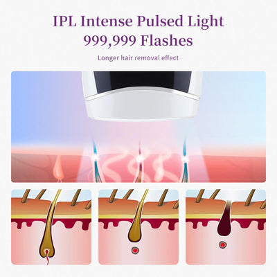 5-Speed Laser Hair Removal | Best Laser Hair Removal Machine