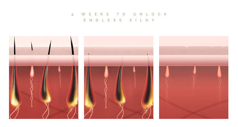 Laser Hair Removal | Laser Hair Removal Before and After