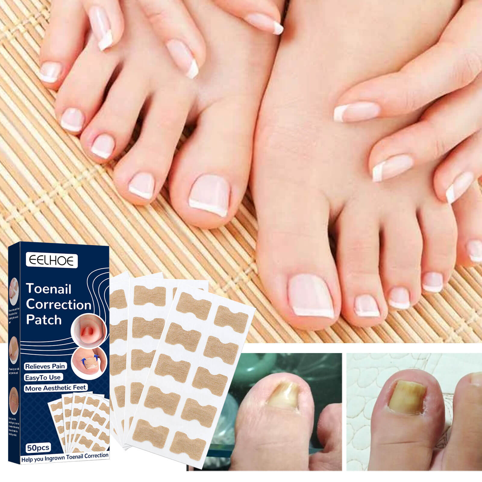 Nail Correction Patch | Best Nail Repair Patch