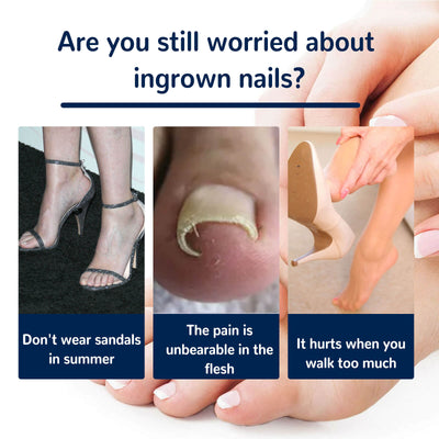 Nail Correction Patch | Best Nail Repair Patch