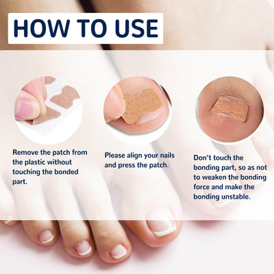 Nail Correction Patch | Best Nail Repair Patch