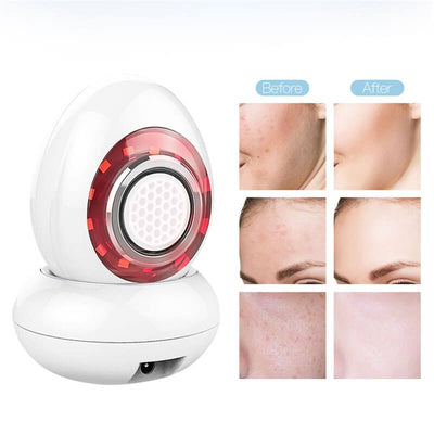 Radio Frequency Facial Care Machine | RF Facial Lifting Machine